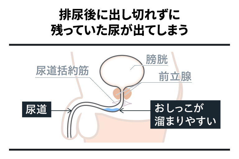 排尿後に出し切れずに残っていた尿が出てしまう